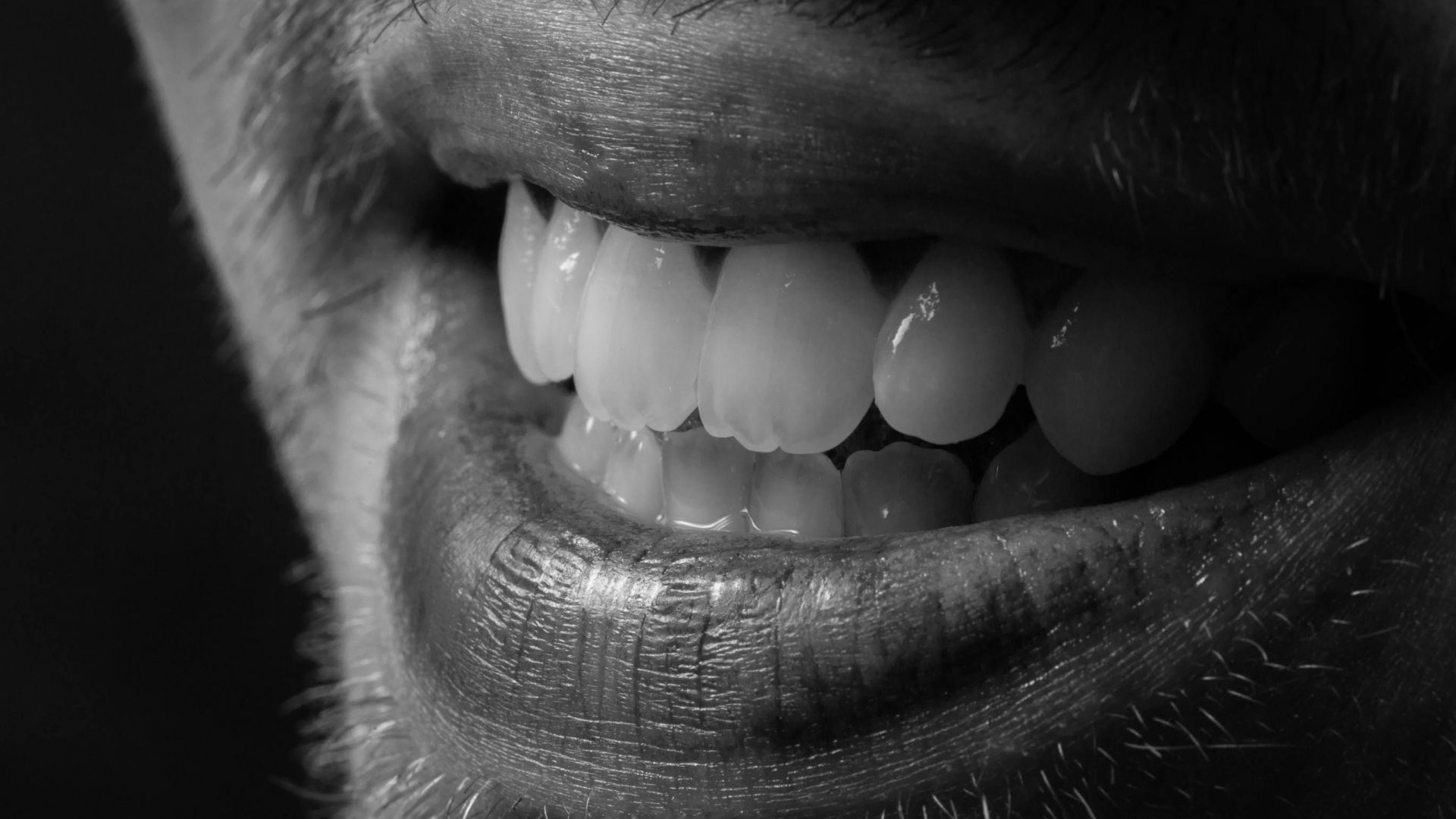 Dental Implants How does it work? Dr. Lincoln R. Fantaski